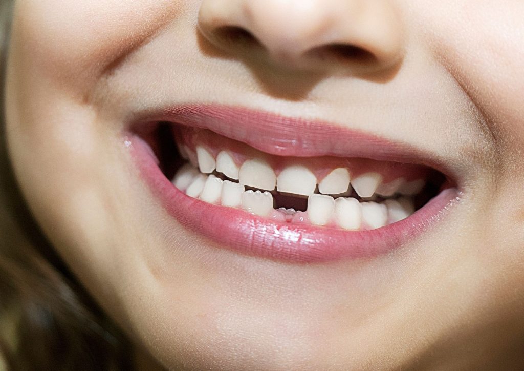Expert Dental Implants