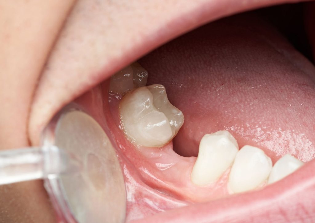 Best Dental In Penang
