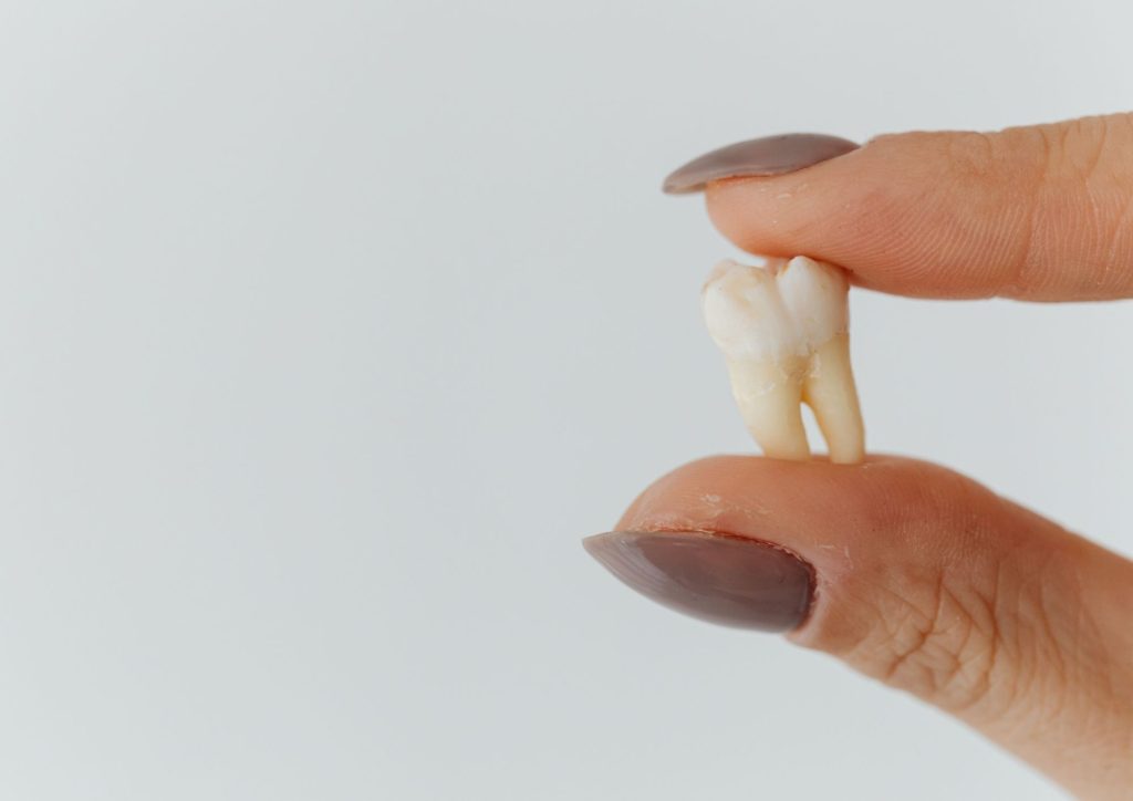 Expert Dental Implants