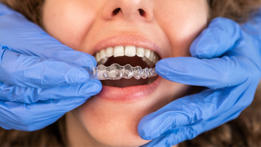 Is Invisalign Painful? What to Expect During Treatment